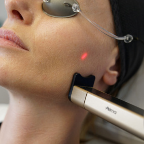 CO2 | BLACK FRIDAY 2025