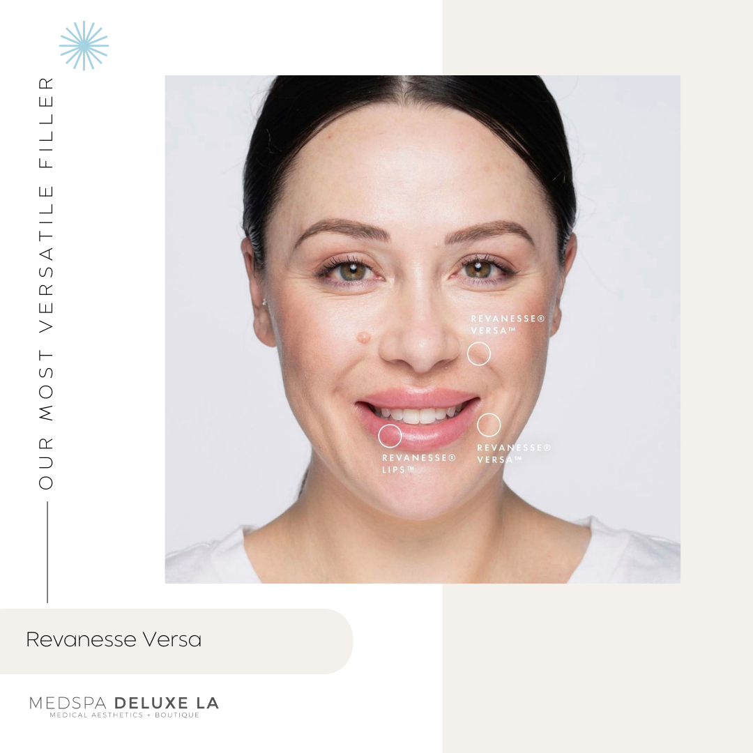 $100 OFF LIP FILLER | JUNE 2026