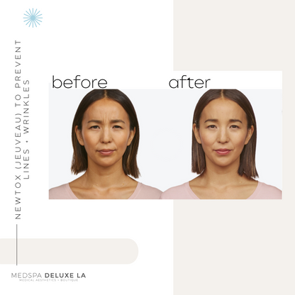 JEUVEAU BUY 55 UNITS GET $55 OFF  | MAY SPECIAL