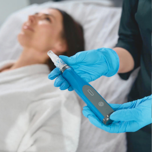 $100 OFF: MICRONEEDLING W/ PRP