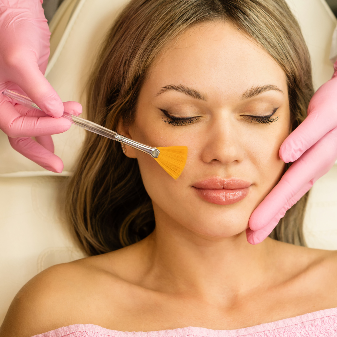 CHEMICAL PEELS -10 YEAR