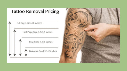 TATTOO REMOVAL | BLACK FRIDAY 2025